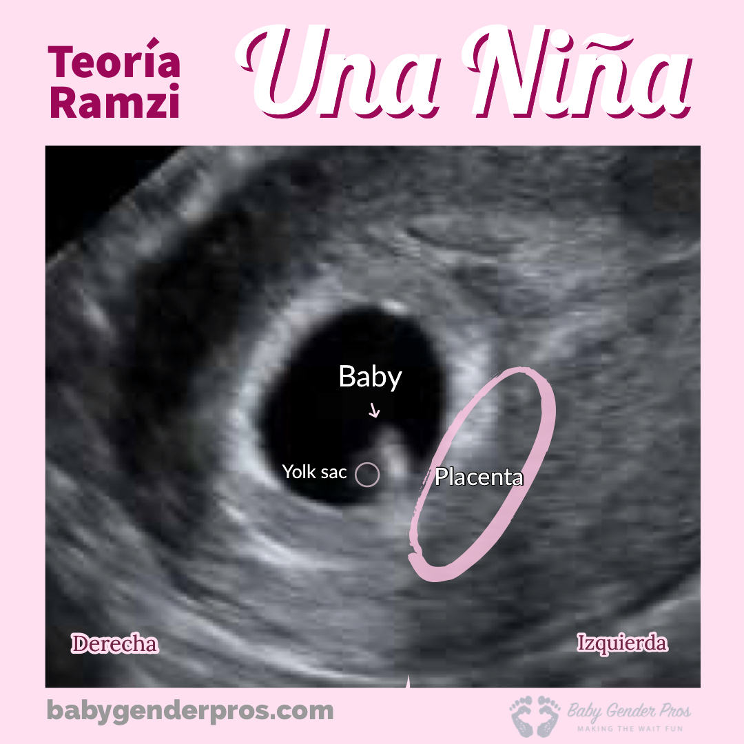 Pin En Babies regarding Calendario Chino Embarazo 2020 Fiable