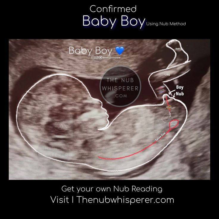 Baby Boy ? Nub Theory | Gender Prediction, Gender Chart with regard to Twin Gender Predictor