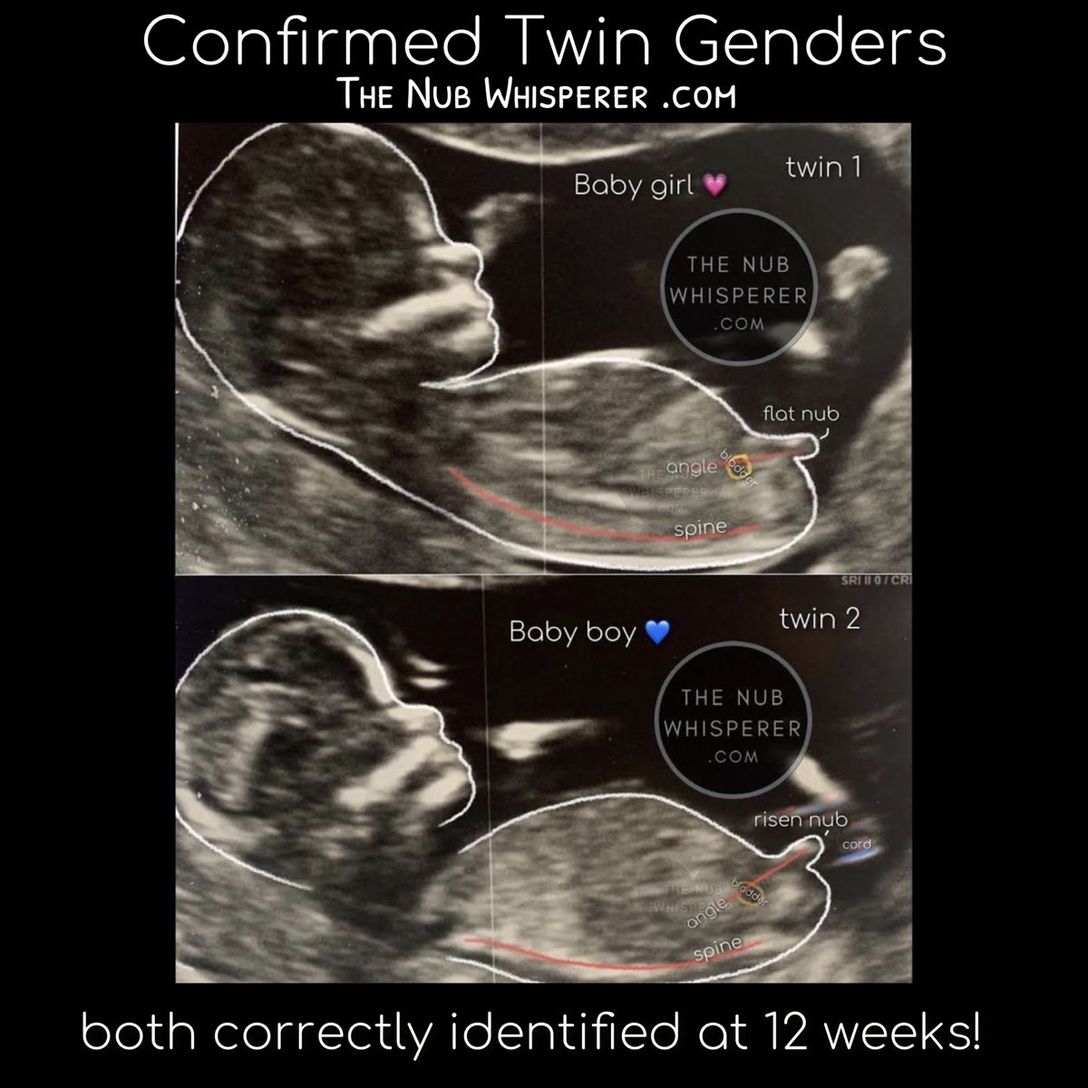 Click My Webpage To Get Yours! In 2020 | Gender Prediction with Twin Gender Predictor